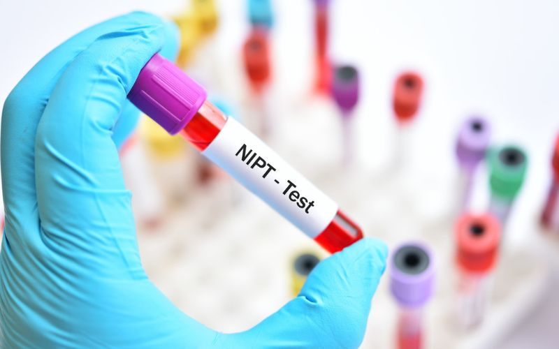 Phương pháp xét nghiệm dị tật NIPT (Ảnh: Sưu tầm Intenret)