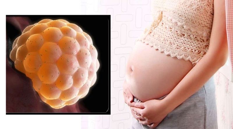 Bệnh thai trứng là gì? (Ảnh: Sưu tầm Internet)