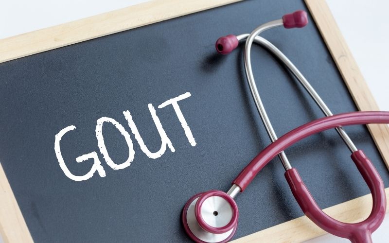Bệnh gút thường xuất hiện ở nam giới. (Ảnh: Sưu tầm Internet)