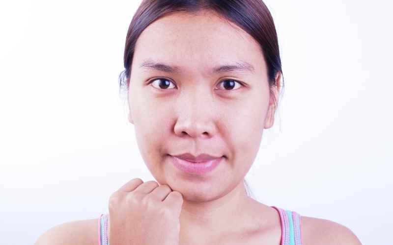 Nội tiết tố thay đổi khiến da mặt bà bầu trở nên thâm sạm, nám, tàn nhang. (Ảnh: Sưu tầm Internet)