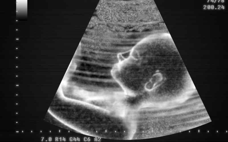 Thai nhi 7 tháng tuổi có thể hít và thở ra một ít ối. (Ảnh: Sưu tầm Internet)