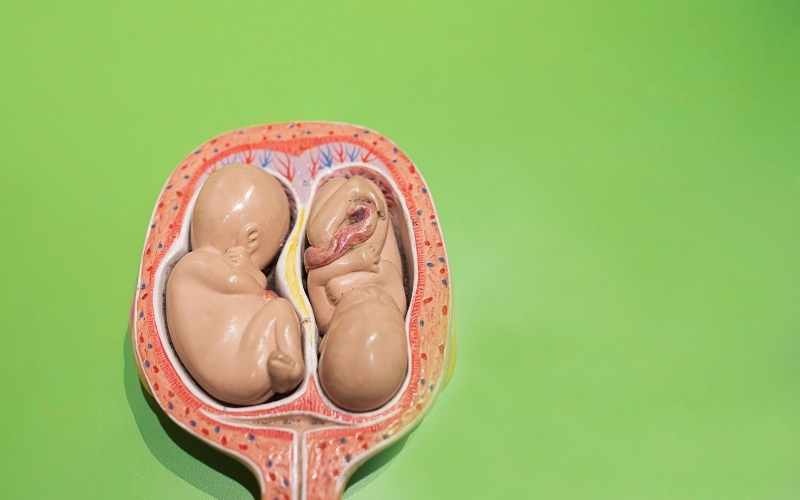 Mang thai đôi là mẹ bầu mang thai cùng lúc hai em bé. (Ảnh: Sưu tầm Internet)