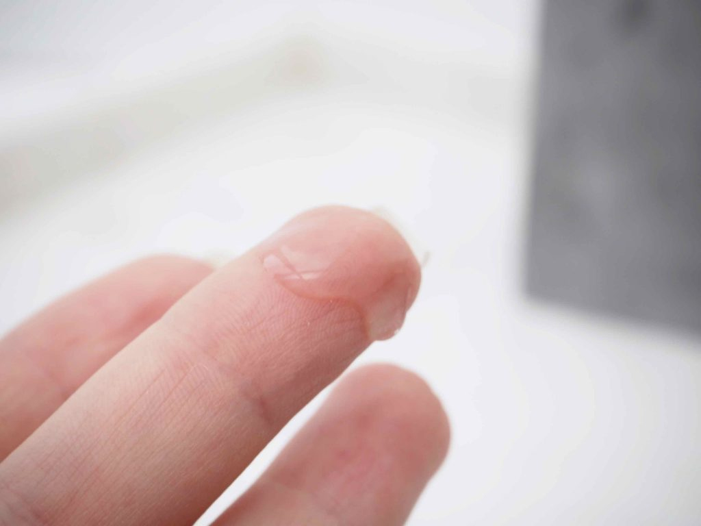 Dịch nhầy cổ tử cung là gì? (Ảnh: Sưu tầm Internet)