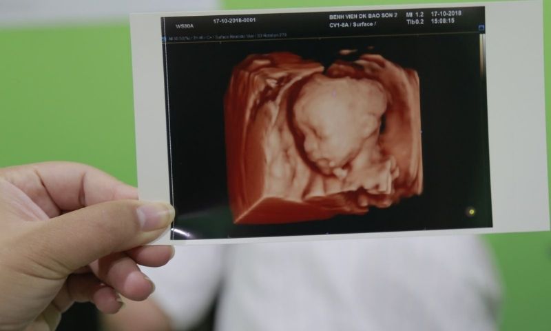 Có nhiều nguyên nhân gây ra dị tật ở thai nhi. (Ảnh: Sưu tầm Internet)