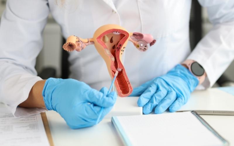 Tổng quan về bệnh u nang buồng trứng. (Ảnh: Sưu tầm Internet)