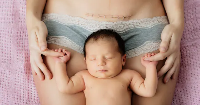 Các mẹ sinh mổ cần kiêng cữ từ 2-3 tháng trước khi ăn hải sản (Ảnh: Sưu tầm Internet)