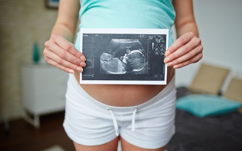 Mẹ bầu cần lưu ý để phòng tránh gây hội chứng Down cho thai nhi. (Ảnh: Sưu tầm Internet)