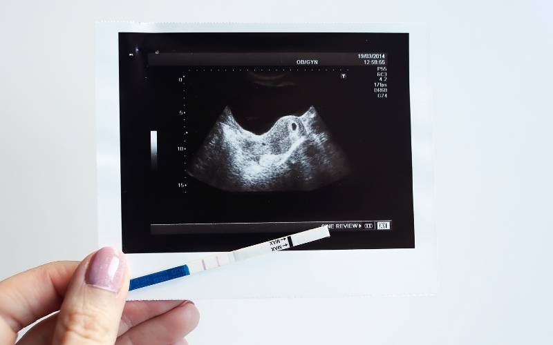 Siêu âm để kiểm tra tình trạng sức khỏe phôi thai. (Ảnh: Sưu tầm Internet)