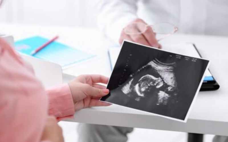 Siêu âm là biện pháp chính xác để xác định việc mang mai  (Ảnh: Sưu tầm Internet)