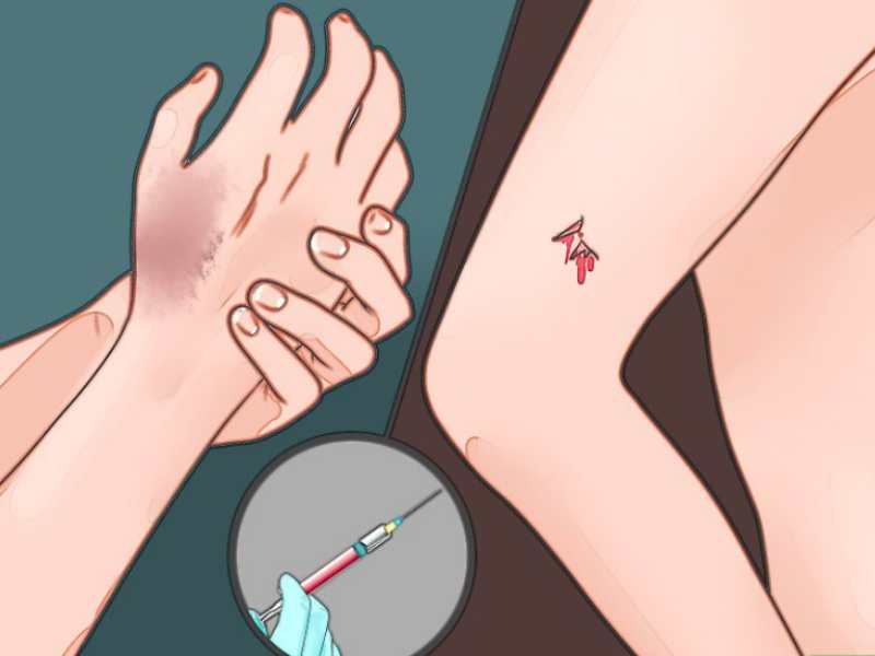 Phòng ngừa nguy cơ hoại tử nếu chưa tiêm vắc xin uốn (Ảnh: Sưu tầm internet)