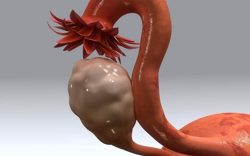 Bệnh nhân bị polyp cổ tử cung vẫn có thể mang thai. (Ảnh: Sưu tầm Internet)