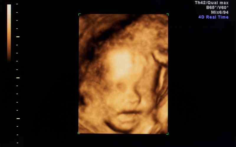 Hình ảnh thai nhi 3 tháng cuối. (Ảnh: Sưu tầm Internet)