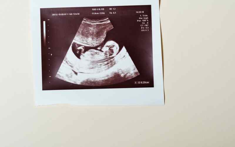 Thai nhi 5 tháng tuổi phát triển nhanh về kích thước và trọng lượng. (Ảnh: Sưu tầm Internet)