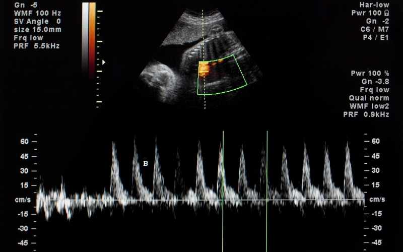 Tim thai thường bắt đầu xuất hiện từ tuần 6-8 của thai kỳ. (Ảnh: Sưu tầm Internet)