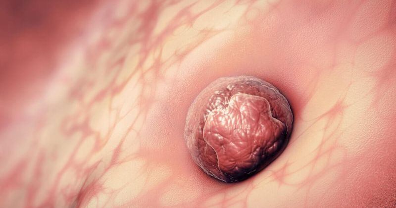 Thai nhi 2 tuần sẽ có kích thước rất nhỏ và chỉ bằng hạt mè  (Ảnh: Sưu tầm Internet)