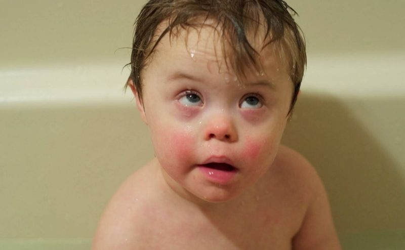 Một số loại dị tật bẩm sinh ở thai nhi thường gặp. (Ảnh: Sưu tầm Internet)