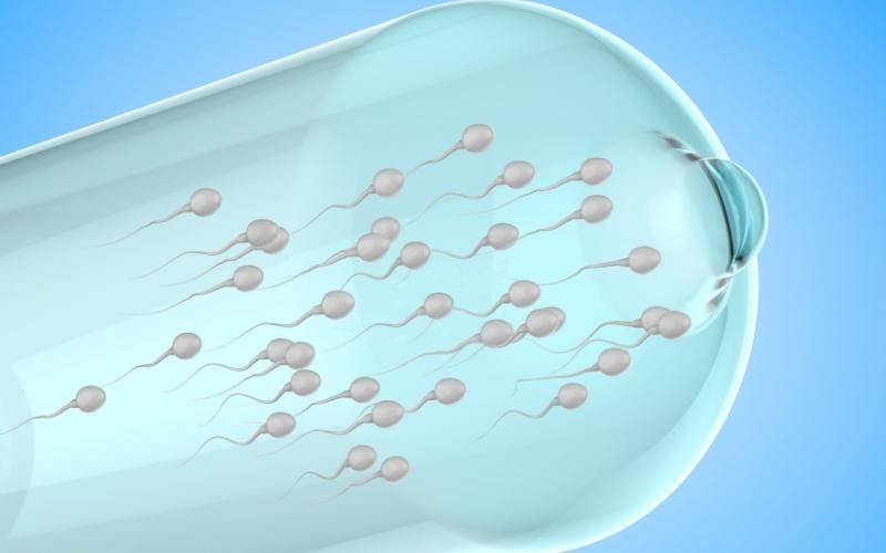 Ngăn chặn tinh trùng. (Ảnh: Sưu tầm Internet)