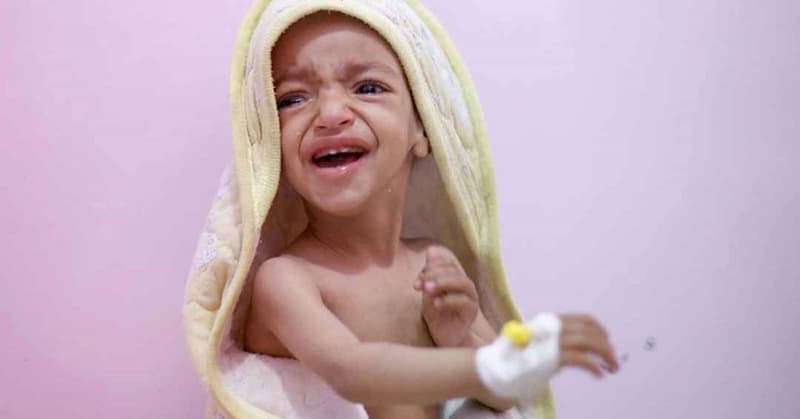 Phụ huynh nên chú ý đến biểu hiện của trẻ để có thể sớm phát hiện và điều trị bệnh. (Ảnh: Sưu tầm Internet)