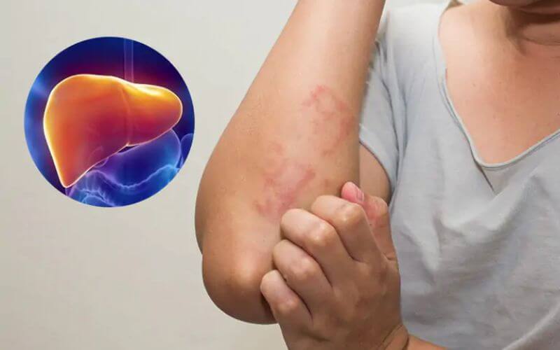 Một số tác hại của thực phẩm chức năng nếu sử dụng không đúng. (Ảnh: Sưu tầm Internet)