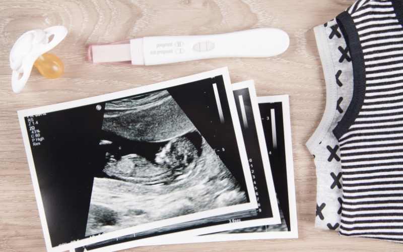 Thai nhi 17 tuần đang phát triển nhiều cơ quan bộ phận. (Ảnh: Sưu tầm Internet)