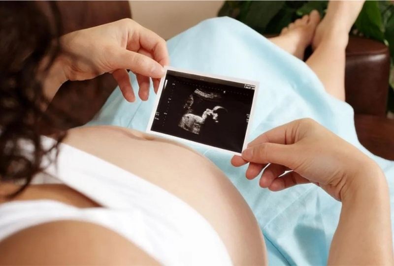 Thai phụ lớn tuổi hoặc từng có tiền sử sinh con bị Down làm tăng nguy cơ thai nhi bị Down. (Ảnh: Sưu tầm Internet)