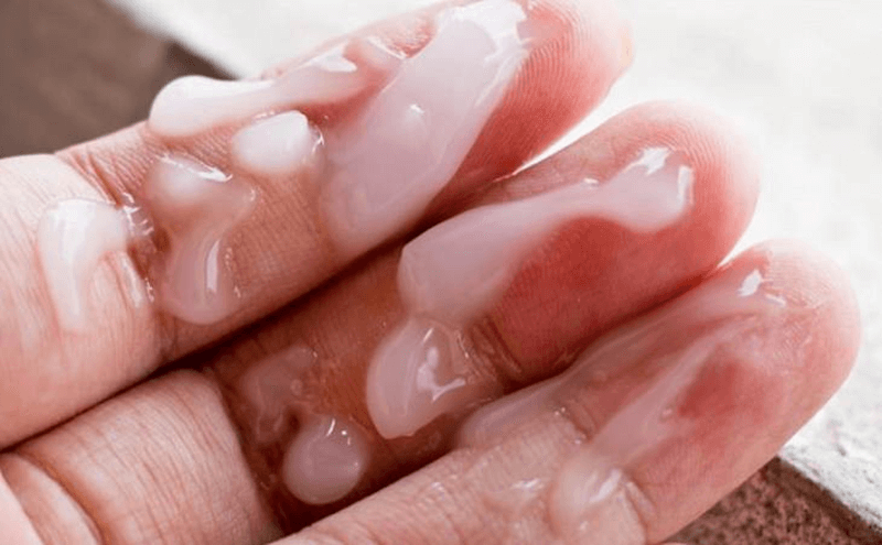 Bệnh lý và di truyền khiến tinh trùng nam giới yếu. (Ảnh: Sưu tầm Internet)