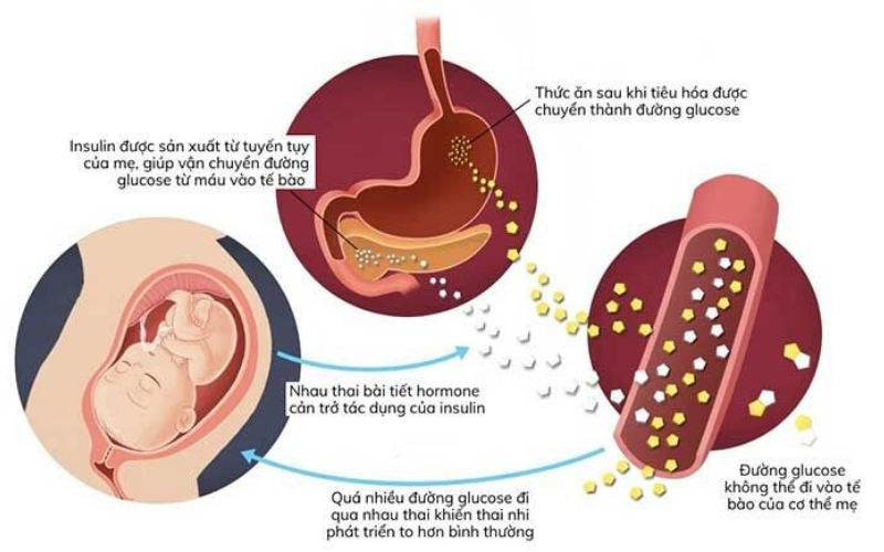                  Ảnh hưởng xấu của rối loạn đường huyết (Ảnh: Sưu tầm Internet)