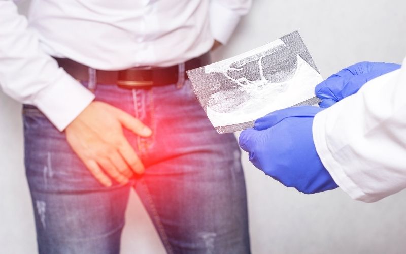 Quai bị làm tăng nguy cơ vô sinh ở nam giới. (Ảnh: Sưu tầm Internet)