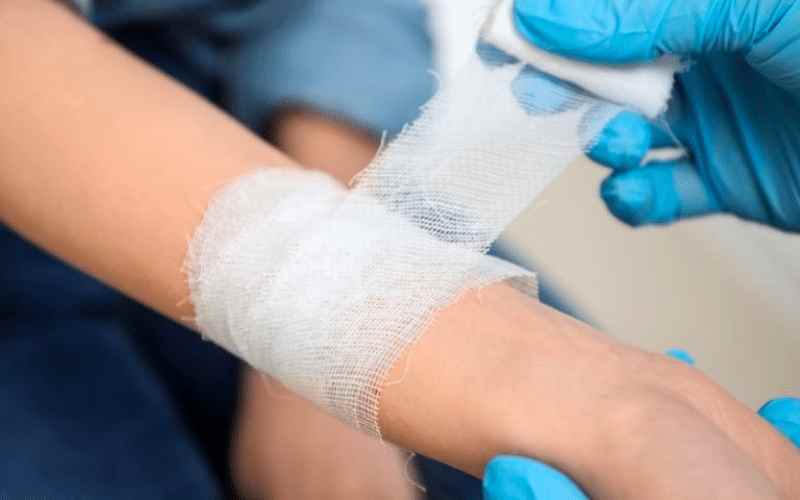 Băng nhẹ vết thương bằng gạc vô trùng để vết thương không bị nhiễm trùng (Ảnh: Sưu tầm internet)