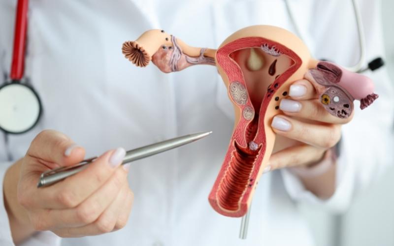 Cắt 2 bên buồng trứng khiến phụ nữ không thể sinh con. (Ảnh: Sưu tầm Internet)