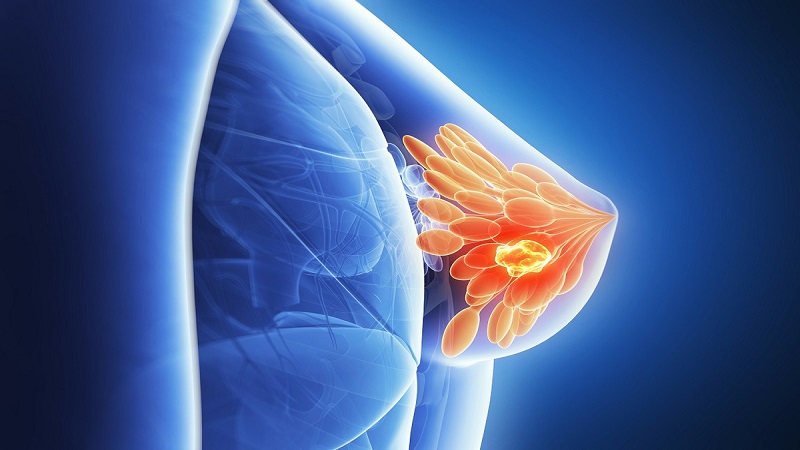 Cho con bú giúp kiểm soát sự hình thành của các tế bào ung thư (Ảnh: Sưu tầm Internet)