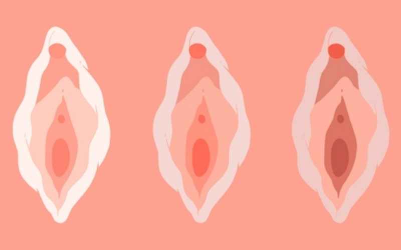 Âm đạo của mẹ thường có màu đỏ thẫm khi mang thai  (Ảnh: Sưu tầm Internet)