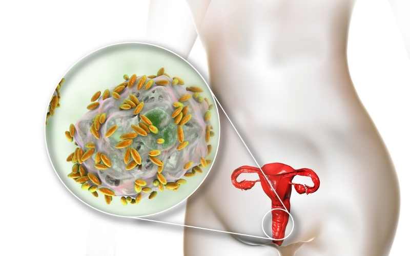 Nhiễm trùng âm đạo khiến thai phụ bị ra máu. (Ảnh: Sưu tầm Internet)