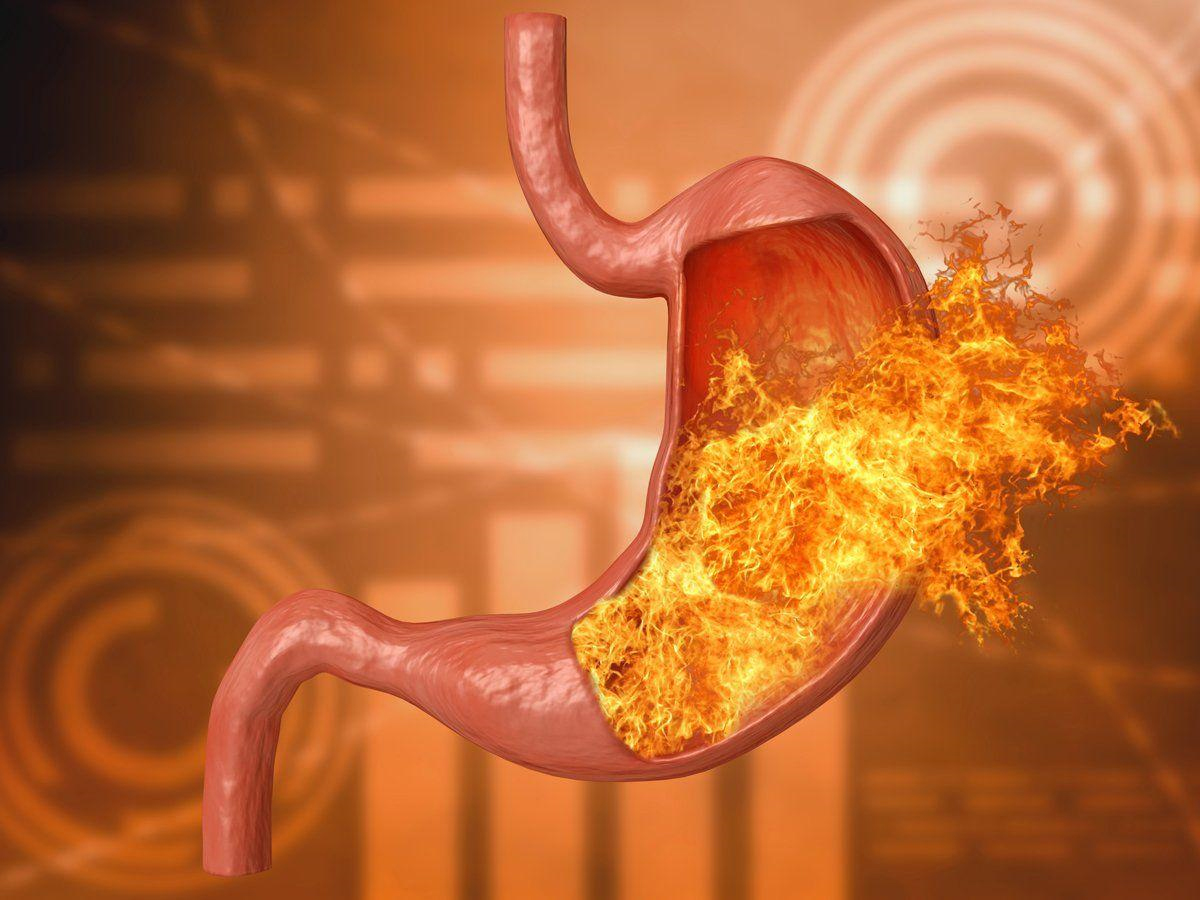 Vấn đề về dạ dày là một trong những nguyên nhân cần chú ý. (Ảnh: Sưu tầm Internet)