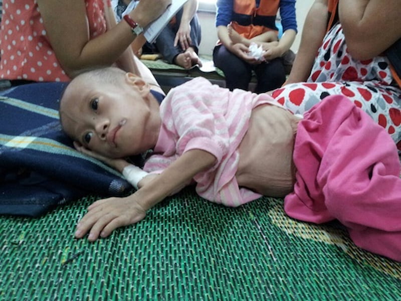 7 nguyên nhân chính khiến trẻ 8 tuổi suy dinh dưỡng - phần chính. (Ảnh: Sưu tầm Internet)