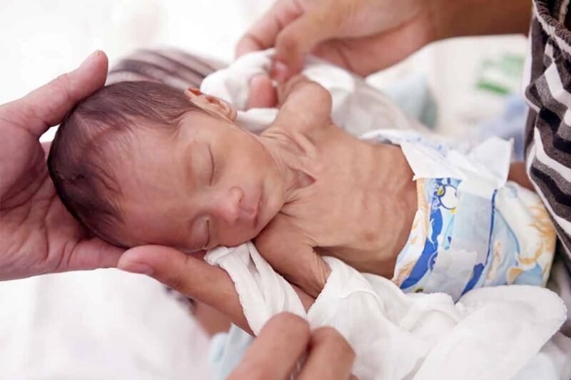 Suy dinh dưỡng thể nhẹ cân xuất phát từ nhiều nguyên nhân khác nhau cũng như đều gây ra những hậu quả nghiêm trọng. (Ảnh: Sưu tầm Internet)