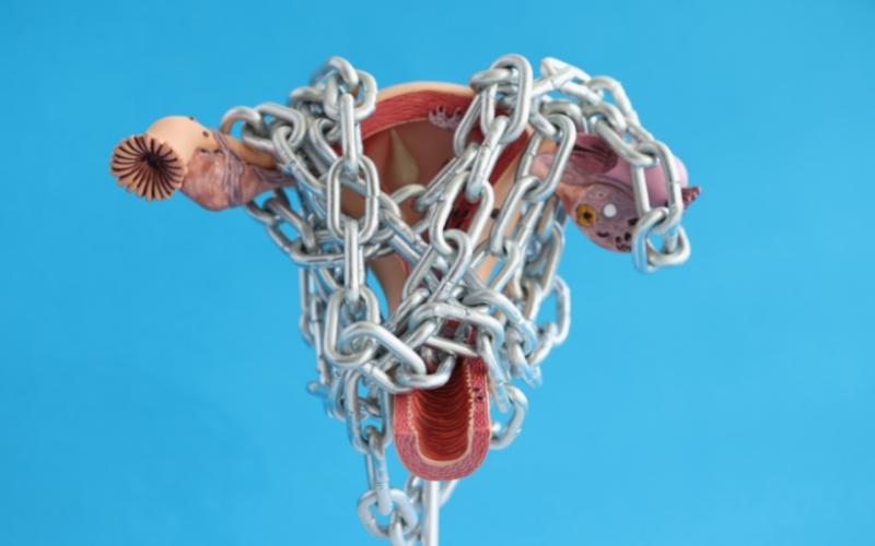 Tắc vòi trứng ở nữ giới. (Ảnh: Sưu tầm Internet)