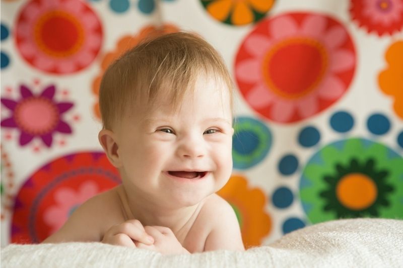 Khi trẻ được sinh ra mới thể hiện rõ các bất thường của hội chứng Down. (Ảnh: Sưu tầm Internet)
