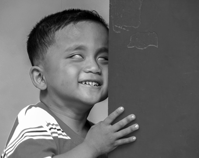 Khiếm khuyết nhận thức thị giác/vận động thị giác ở trẻ. (Ảnh: Sưu tầm Internet)