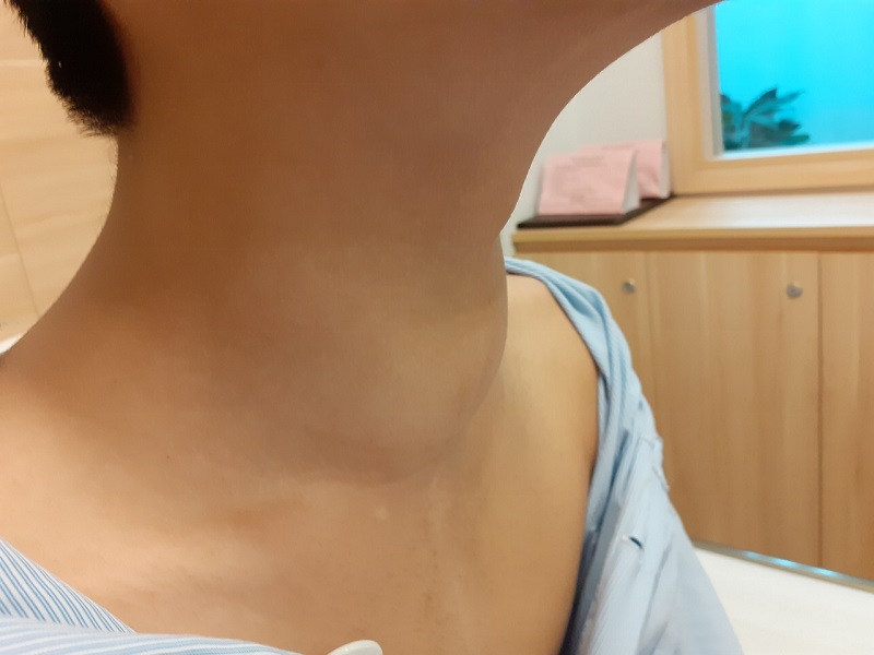 U tuyến giáp ảnh hưởng đến chức năng sinh sản của nữ giới. (Ảnh: Sưu tầm Internet)