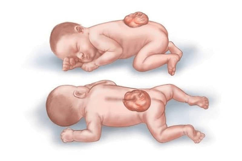 Ngăn ngừa khuyết tật bẩm sinh. (Ảnh: Sưu tầm Internet)