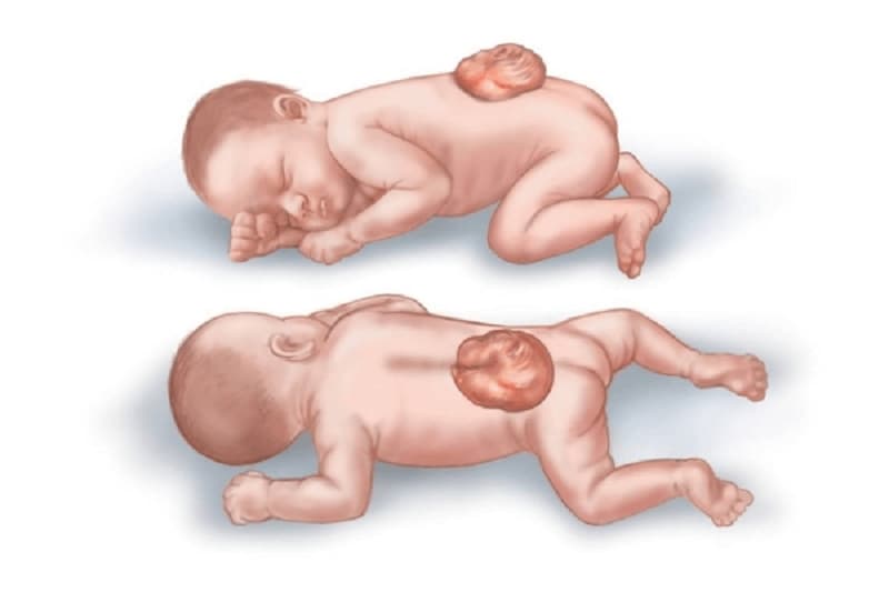 Thừa Vitamin B7 có thể tăng khả năng dị tật trên thai nhi. (Ảnh: Sưu tầm Internet)