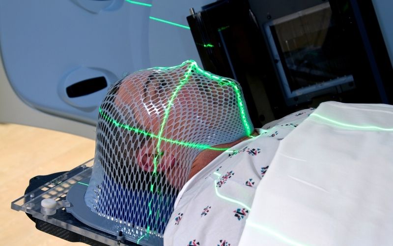 Nam giới cũng có nguy cơ bị vô sinh khi xạ trị. (Ảnh: Sưu tầm Internet)