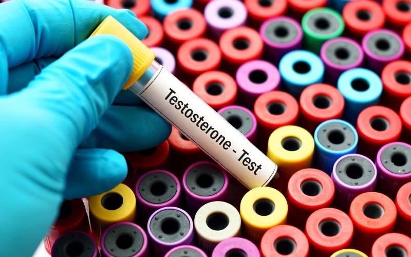 Xét nghiệm Testosterone ở nữ giới. (Ảnh: Sưu tầm Internet)
