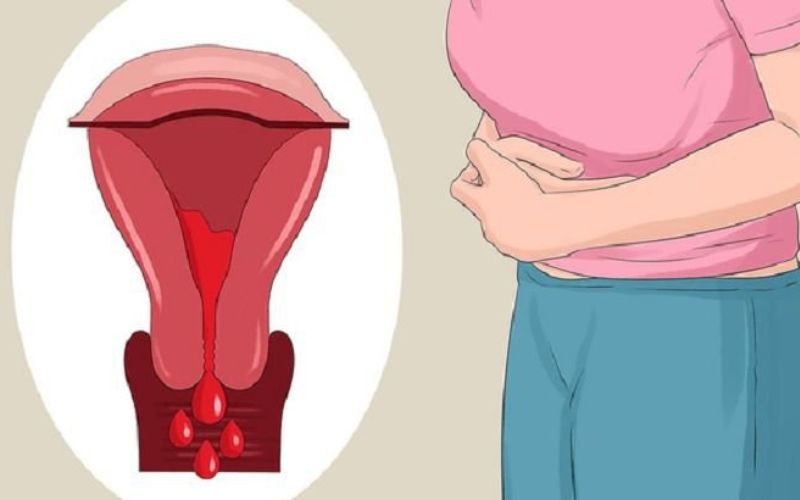 Chảy máu âm đạo ở bà bầu tháng cuối là do đâu? (Ảnh: Sưu tầm internet)