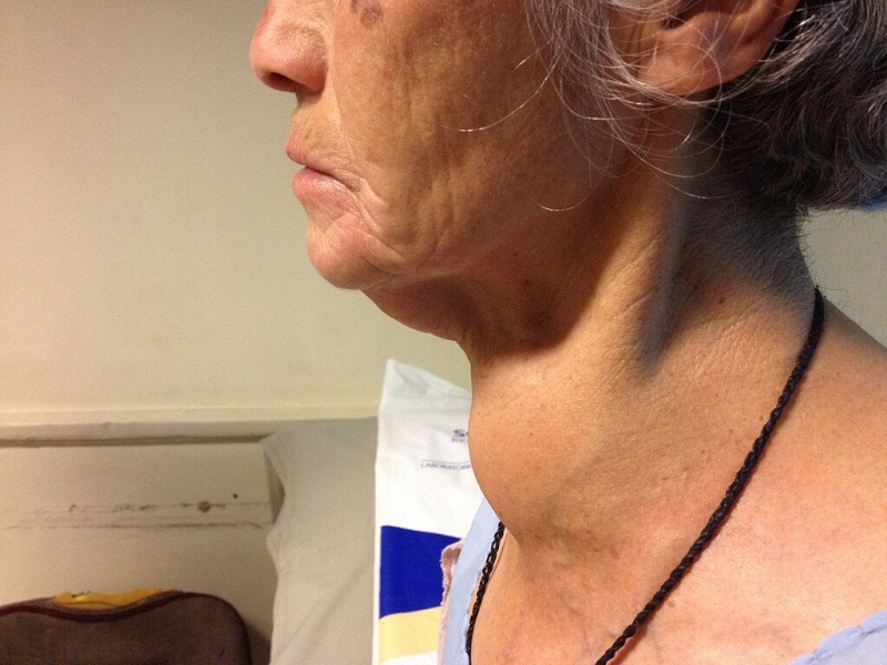 Người cao tuổi có nguy cơ mắc bệnh cao hơn cả. (Ảnh: Sưu tầm Internet)