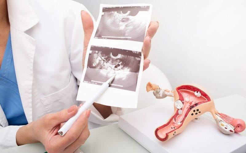 Bệnh nhân buồng trứng đa nang có thể mang thai nếu điều trị kịp thời. (Ảnh: Sưu tầm Internet)