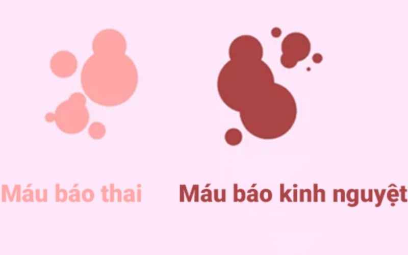 Máu báo thai thường xuất hiện sau 10-14 ngày khi mẹ mang thai  (Ảnh: Sưu tầm Internet)