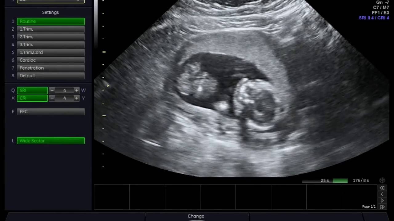 Thai nhi 16 tuần tuổi phát triển như thế nào? (Ảnh: Sưu tầm Internet)