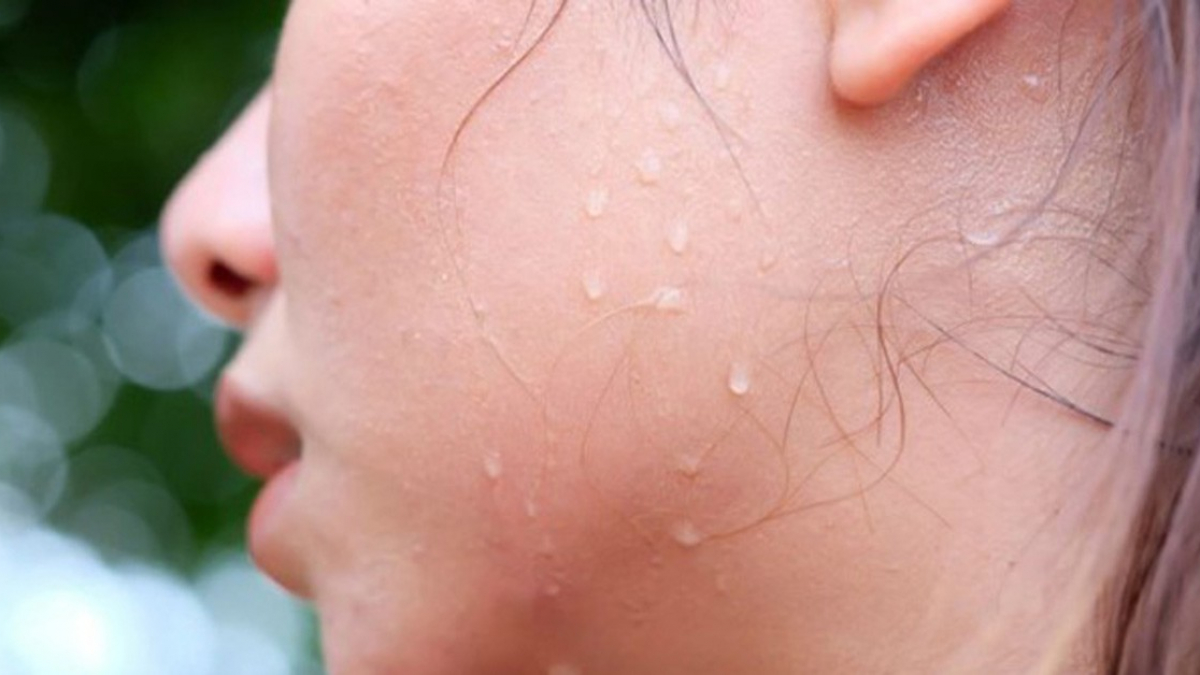 Ra nhiều mồ hôi. (Ảnh: Sưu tầm Internet)